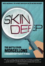 Watch Skin Deep: The Battle Over Morgellons 123MovieFree