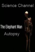 Watch Science Channel Elephant Man Autopsy 123MovieFree