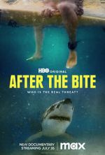 Watch After the Bite 123MovieFree