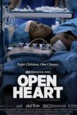 Watch Open Heart 123MovieFree