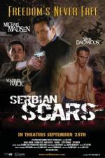 Watch Serbian Scars 123MovieFree