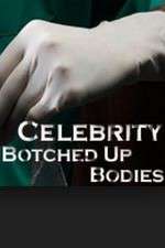 Watch Celebrity Botched Up Bodies 123MovieFree
